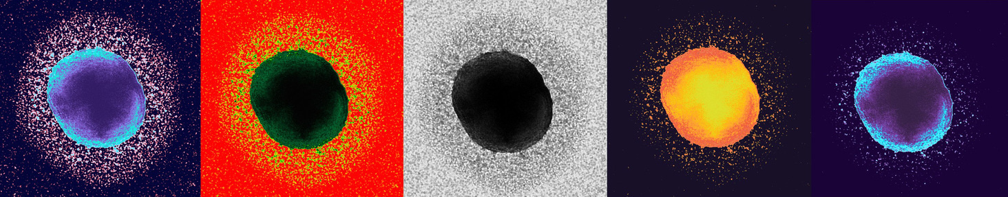 “It’s definitely not a lipid…”